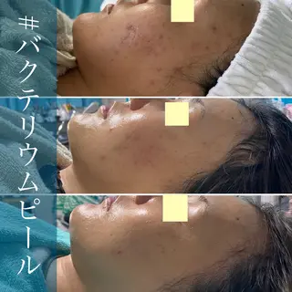 メンズ歓迎🙆‍♀️ エステ/ネイルISTのネイルデザイン