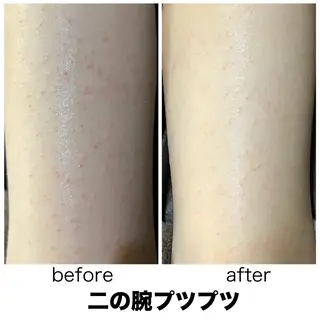 leolo武蔵浦和 肌質改善＆脱毛のエステ・リラクイメージ