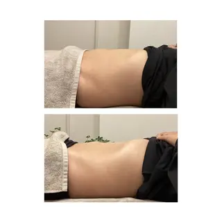 小顔サロンSharp …腸調整よもぎ蒸しのエステ・リラクイメージ