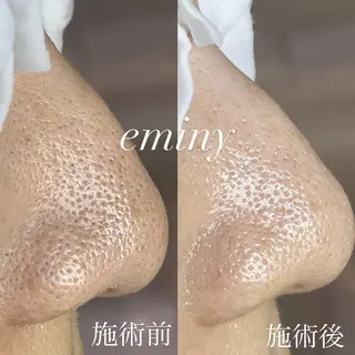 EMINY （エステティシャン）のエステ・リラクイメージ