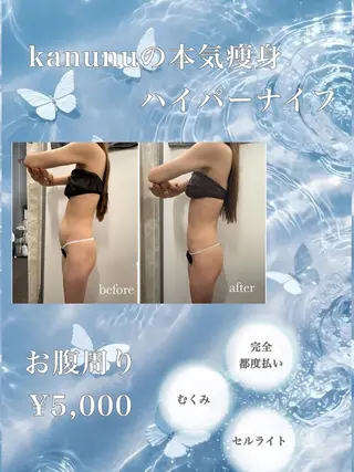 Kanunu所属・鶴橋エステ kanunuのエステ・リラクイメージ