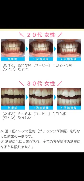 WHITENING ハウスのマツエク・マツパデザイン