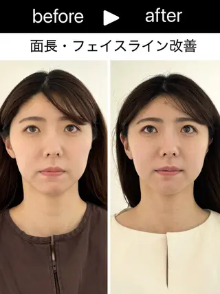 小顔矯正 骨盤矯正 美容整体サロン ELVISA TOKYO 恵比寿院所属・古川 智也のエステ・リラクイメージ