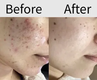 都度払い 肌質改善専門サロンのエステ・リラクイメージ