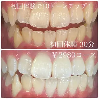 ホワイトニングルーム　川崎店所属・ホワイトニング ルーム　川崎店のその他イメージ