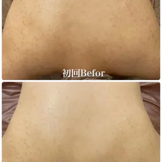 ショート カラー パーマ ヘアアレンジ メンズ キッズ ネイル マツエク・マツパ アイブロウ 【ハーブ×毛穴洗浄】 THE MORE千葉のエステ・リラクイメージ