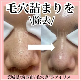 Aki 似合わせまつ毛💎のエステ・リラクイメージ