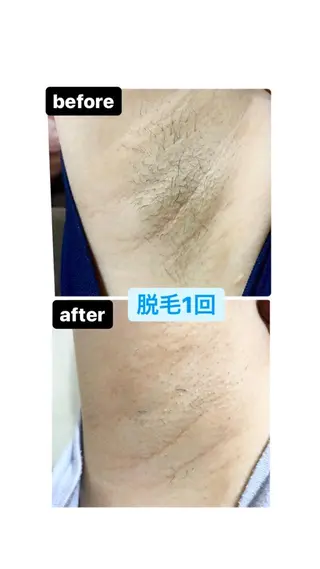 脱毛・エステサロン LuLuNのエステ・リラクイメージ