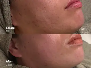 Mau beauty salon所属・Mau (マウ)のエステ・リラクイメージ