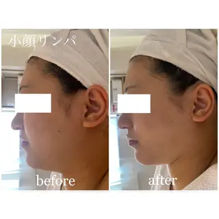 I'm -ｲﾑ-所属・肌質改善／ブライダル I'm.-イム-のエステ・リラクイメージ