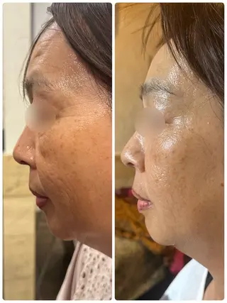 Sena Dewi所属・Sena Dewi SAE🌼のエステ・リラクイメージ