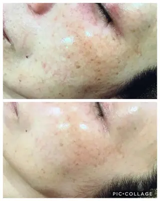 ジョリ   ヴェール 山口のマツエク・マツパデザイン