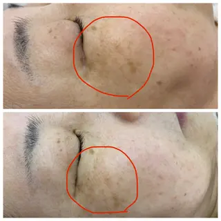 CEサロンblanc bebe所属・高村 有紀のエステ・リラクイメージ