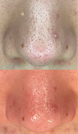 お肌のかかりつけサロンP.A.L.M.所属・【P.A.L.M.】 むき卵×毛穴レス肌のエステ・リラクイメージ