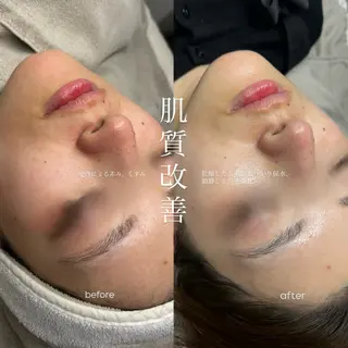 neki所属・neki eyelashのマツエク・マツパデザイン