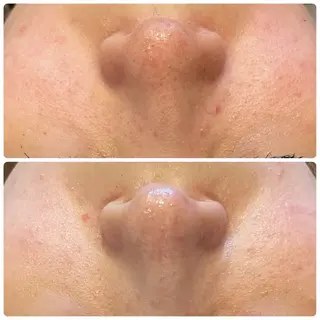 yellow.所属・yellow💛【 脱毛&フェイシャル】のエステ・リラクイメージ