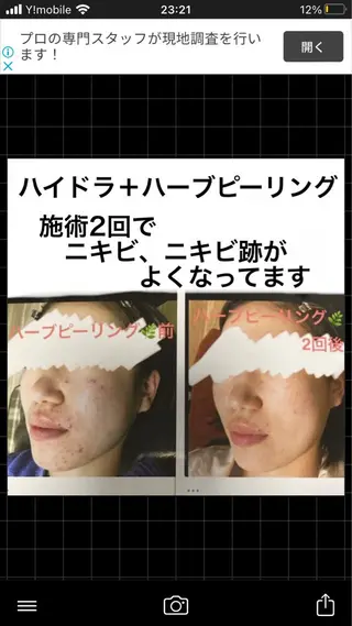 ショート カラー パーマ ヘアアレンジ メンズ キッズ ネイル マツエク・マツパ アイブロウ ハーブピーリング専門 🌿モッカのエステ・リラクイメージ