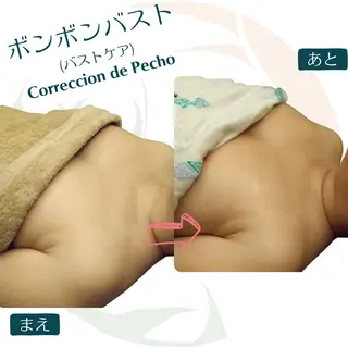 小顔矯正☀︎バスト ☀︎ハルのエステ・リラクイメージ