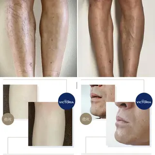 メンズ glosstokyo所属・縮毛矯正技師須藤玲人 髪質改善師ゴトウのヘアスタイル