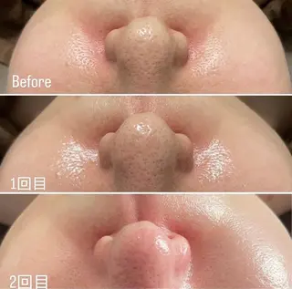 salon de   Be所属・salondeBe 🩵フェイシャル専門のエステ・リラクイメージ