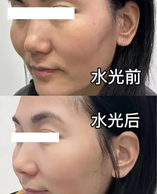 マツエク・マツパ 愛維美水光美肌専門店所属・愛維美水光美肌専門店 メンズレディースokのエステ・リラクイメージ