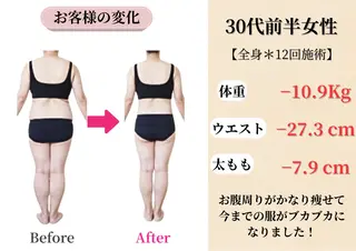 Belle White所属・本格痩身＊肌質改善＊ BelleWhiteのエステ・リラクイメージ