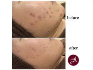 ショート カラー パーマ ヘアアレンジ メンズ キッズ ネイル マツエク・マツパ ニキビ・肌質改善専門 ♡人生が変わるサロンのエステ・リラクイメージ