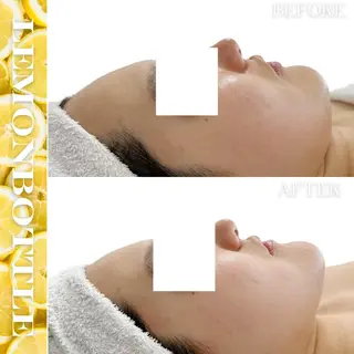 Liam《美肌管理/ 3D小顔/脂肪ケア》のエステ・リラクイメージ