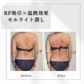 小顔矯正専門店 【RED】池田のエステ・リラクイメージ