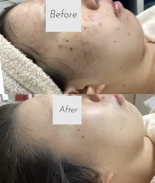 都度払い 肌質改善専門サロンのエステ・リラクイメージ