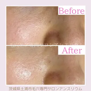毛穴ケア専門サロンアンスリウム所属・茨城土浦 つくば毛穴 ケア専門サロンのエステ・リラクイメージ