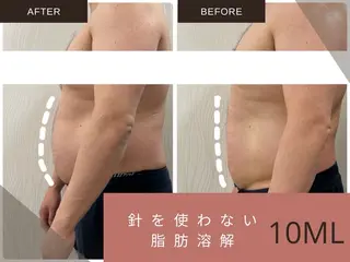 痩身・リラク KOZUEのエステ・リラクイメージ