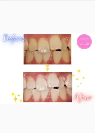 ecxia  white 　広島袋町店所属・セルフホワイトニング エクシア広島袋町店のその他イメージ