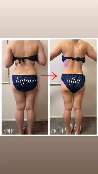 本気で痩せたい方へ 痩身専門サロンのその他イメージ