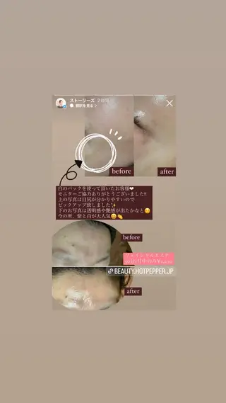 アイカワールド所属・鈴木 愛加のエステ・リラクイメージ