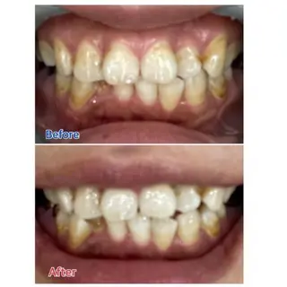 M渋谷店所属・M渋谷 ホワイトニングのエステ・リラクイメージ