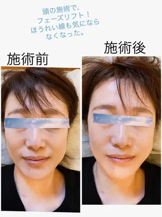 Anne’s happyBonesのエステ・リラクイメージ