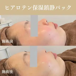 Oncebell. Bodymake&beautysalon所属・Oncebell. ワンベルのエステ・リラクイメージ