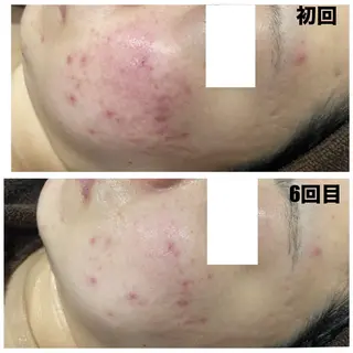 Linoa所属・Linoa（リノア） エステ&リラクのエステ・リラクイメージ