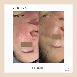 ピーリング専門店 Belluteのエステ・リラクイメージ