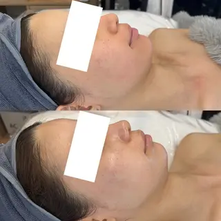 韓国🇰🇷価格 サロン_Nbibiのエステ・リラクイメージ