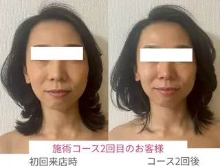 la lumie're (ラ リュミエール)所属・小顔サロン (ラ リュミエール)のエステ・リラクイメージ