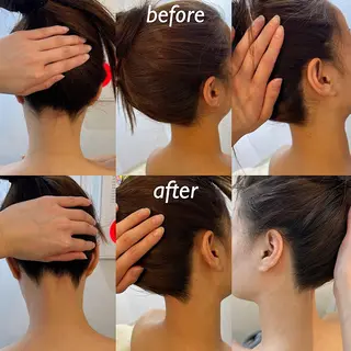 うなじ脱毛/美肌脱毛 LABELのエステ・リラクイメージ