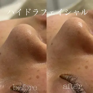 フェイシャルサロン CHIARA 荒田のエステ・リラクイメージ