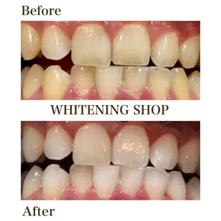 メンズ ホワイトニング ショップ川越店のエステ・リラクイメージ