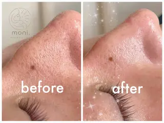 🌿肌質改善 ×美顔ケア💫⟡.のエステ・リラクイメージ