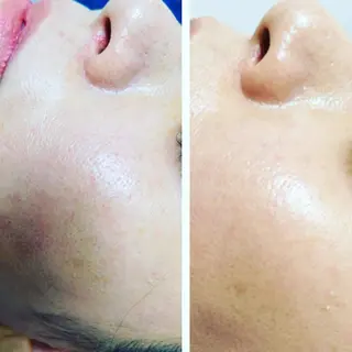 🅖🅤🅩🅔🅛 salonのエステ・リラクイメージ