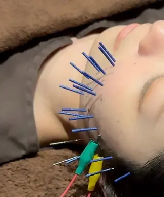 Beauty Salon lau　大山店所属・美容鍼(lau) Maiのエステ・リラクイメージ