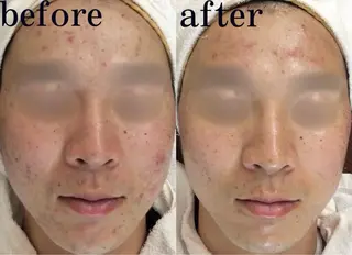 Salon de Bis所属・サロン ド ビス 髙橋美月のエステ・リラクイメージ