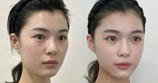 マツエク・マツパ aliaハイフ&水光ジェットサロン所属・aliaハーブ水光店 エステティシャン募集のエステ・リラクイメージ